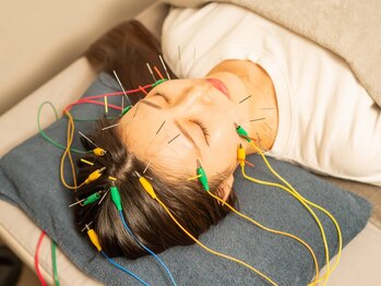 クラリ 春日井院(CLARI)の写真/たるみやほうれい線が気になる方。美容鍼でハリつやUP!もうはずかしくない肌を目指して◎