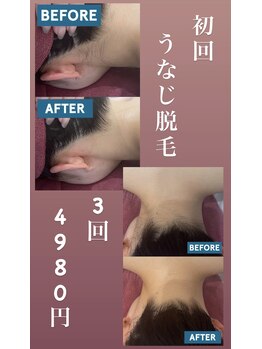ヴォアール 東静岡店(VOIR)/うなじ脱毛