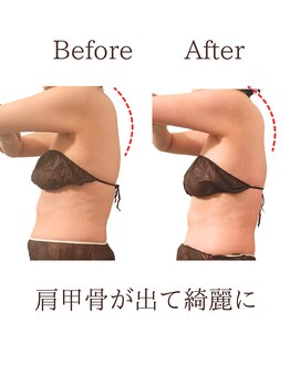 ヴィセル(VISEL)/トータルマイナス10cm痩身