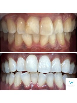 ホワイトニングショップ 奈良生駒店/本来の白さへ