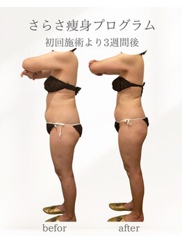 ナチュラル ビューティー スタイル さらさ(Natural Beauty Style)/初回体験より3週間後