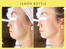 シロカネ イオンタウン西熊本店(SHIROKANE)/レモンボトル☆