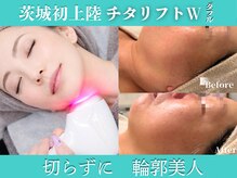 プラウディア(PROUDIA)