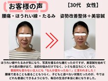 サロンスマイル/30代美容鍼ビフォーアフター