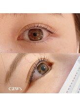 カウズ 西宮北口(CAWS)/アップワードリフト　Cカール