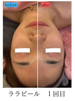 ユフラ(Juhla)/ララピール