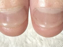 グラシナ 鳥丸店/ケアすることでまっすぐ綺麗に