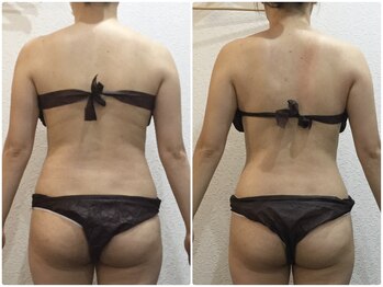 美容整体ウェリナ 名駅院/小顔矯正/骨盤矯正/美脚サロン