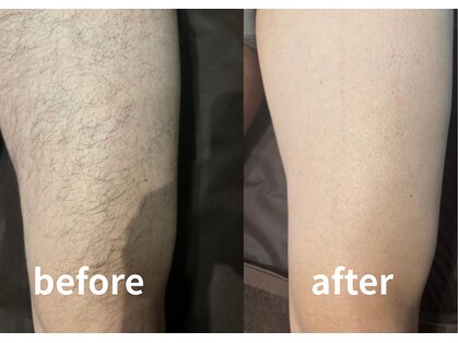 モア男子(MORE男子)の写真