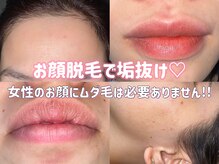 エピジュ 久留米(Epijyu)
