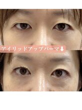プリティアイ(pretty eye)/アイリッドアップパーマ可愛い！