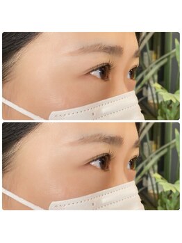 エマ 桃山台(emma)/snap