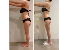 エイジングケアサロン 青山 本店/3種マシン・90分最強痩身！