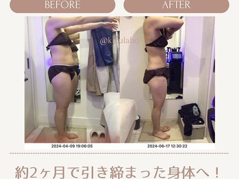 効くラボ 新宿店/厚みをなくしたい方必見！！