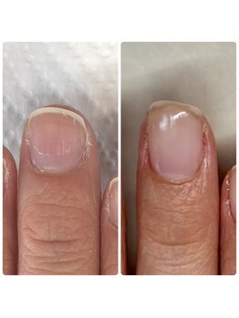 美爪に導くジェルネイル(クリア)