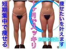 アールズ スリム(R's slim)/本格★痩身効果◎痩せるなら今！