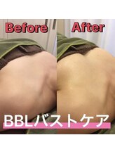 キミドリ(KIMIDORI)/BBLバストケア