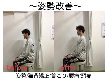 エール シガ(AILE SHIGA)/【姿勢改善】