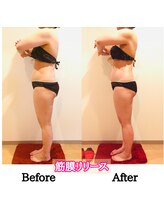 セルフィッシュ(Cellfish)/筋膜リリース