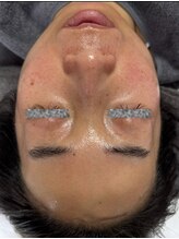 リアスキン(Lia skin)/シミ、毛穴でお悩みの方