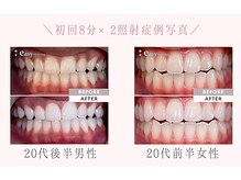 イージーホワイトニング 神戸三宮店(easy whitening)