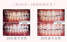 イージーホワイトニング 神戸三宮店(easy whitening)
