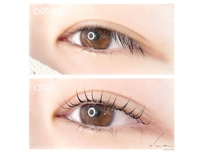 エルア(elua)の写真