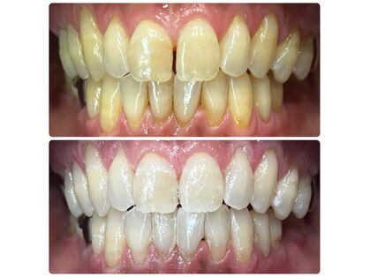 歯科衛生士のホワイトニングサロン【total beauty n+】の写真