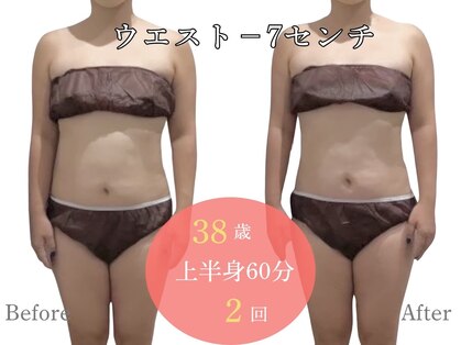 アルピナ(ALPINA)の写真