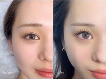 リエルブランク(Liell blanc)の雰囲気（アンドヘルシーで瞳の印象をはっきりと◎【&healthy】北浜/本町）