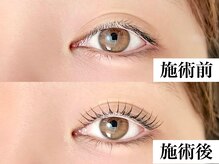 ドルチェ(Dolce)/まつげパーマ専門店