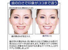 ホワイトニングショップ 岸和田店/ここまで印象が変わります！