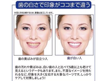 ホワイトニングショップ 岸和田店/ここまで印象が変わります！