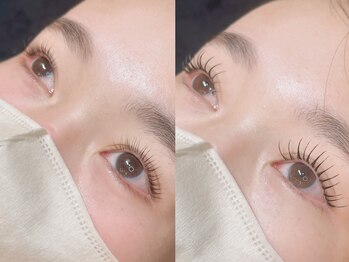 カナウ 銀座店(Kanau)/まつパとパリエクのBefor After