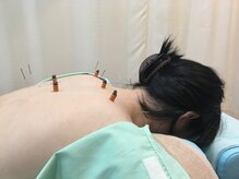 すぎの木鍼灸院