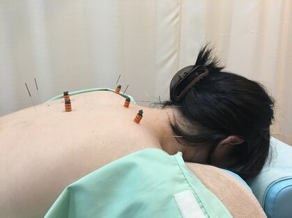 すぎの木鍼灸院の写真