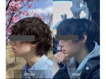 エモアメディカル整体院 麻布十番(Emoaメディカル整体院)/【20代男性】小顔矯正