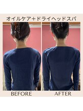 アルパカ(ALPAKA)/体の歪みを放置しない！