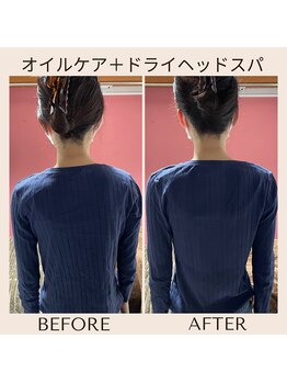 アルパカ(ALPAKA)/体の歪みを放置しない！