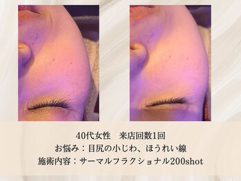 エクストリミティ 国立店(EXTREMITY)/お客様の変化