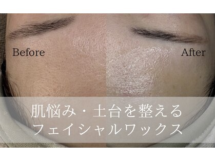 エヌクレアール(Ncrear)の写真