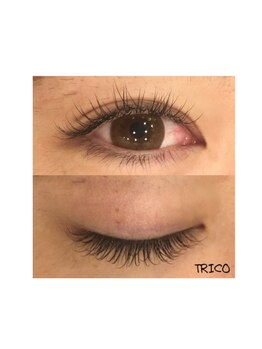 トリコ 狛江(TRICO by hair make passage)/長持ちレーザーラッシュ【狛江】