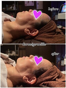 ラネージュミル(La neige mille)/フェイシャル