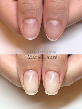 マリーロール 梅田店(Marie Laure)/自爪育成/深爪矯正/ネイルケア