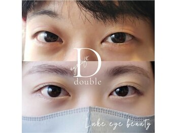 ルークアイビューティ(Luke eye beauty)/ダブルアイリフト