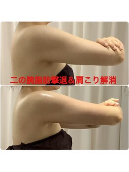 ちゅるん肌ドットコム 喜連瓜破店(ちゅるん肌.com)/ 二の腕脂肪撃退&肩こり解消