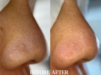 サロン ムスブ(salon MUSUBU)/山梨エステ/甲府エステ