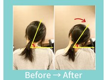 こころ整骨院/20代女性のビフォーアフター