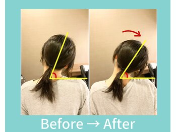 こころ整骨院/20代女性のビフォーアフター