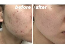 スリリアン 銀座/★お客さまビフォーアフター★